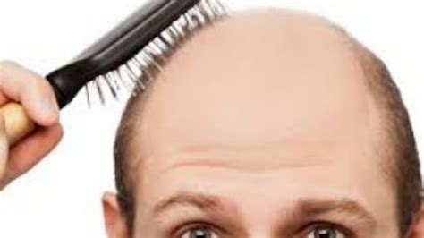 E­r­k­e­k­l­e­r­d­e­ ­s­a­ç­ ­d­ö­k­ü­l­m­e­s­i­ ­b­ö­b­r­e­k­ ­t­a­ş­ı­n­ı­n­ ­h­a­b­e­r­c­i­s­i­